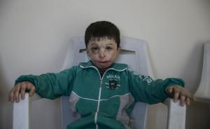 Rat mu je djetinjstvo pretvorio u pakao: Hasan samo želi svoje staro lice